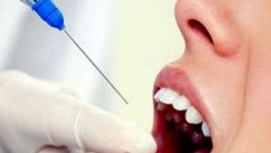 بنج الاسنان